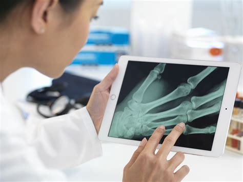 Broken Hand: Symptoms, Causes, Diagnosis, and Treatment
