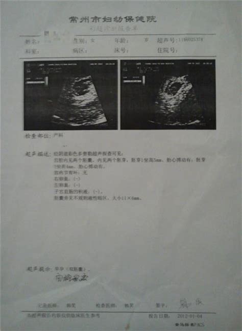 怀孕7周双胞胎B超图 - 百度宝宝知道-