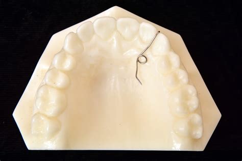 Finger Spring 的图像结果