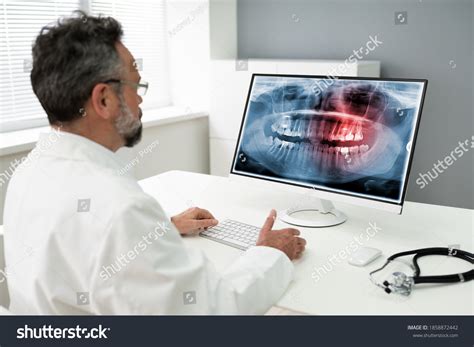 Image result for Dentists Using Computer