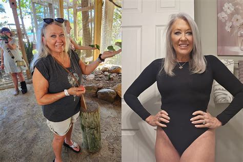 Is Sono Bello Safe? - Sono Bello