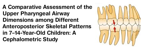 A Comparative Assessment of the Upper Pharyngeal Airway Dimensions ...