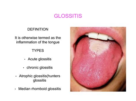 Oral disorders ppt. | PPTX