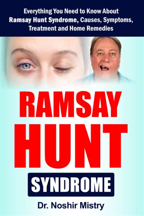 Buy Ramsay Hunt Syndrome: Everything You Need to Know About Ramsay Hunt ...