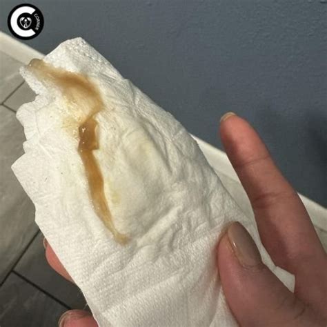 Ovulation Discharge: Its Looks & What It Means - CONCEPTION CORNER