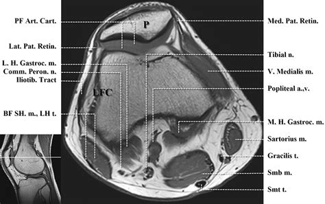 Mri Anatomy Knee Mri Anatomy Of Knee Dr. Muhammad Bin Zulfiqar | PPT