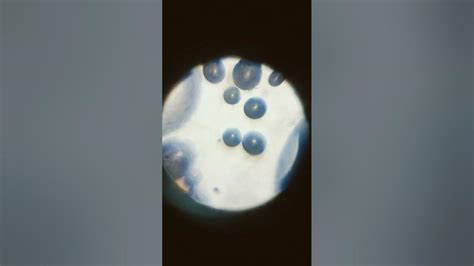 Image result for Bug Infested Baby Monkey