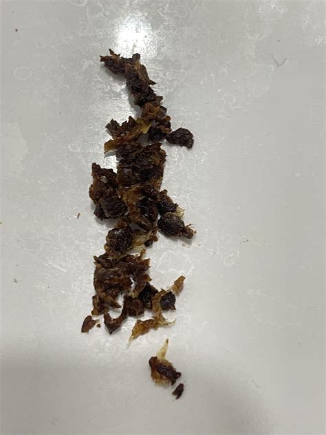 I had some irritation in my ears so I bought a ear cleaning tool with a ...