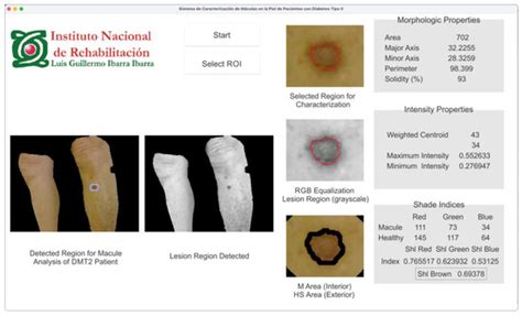 Proposal of a Non-Invasive Measurement of Physical Properties of ...
