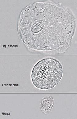 Image result for Transitional Epithelial Cells
