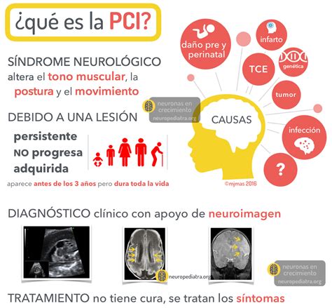 Tratamiento de la parálisis cerebral infantil - neuronas en crecimiento