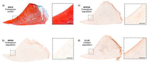 Degradation of Proteoglycans and Collagen in Equine Meniscal Tissues