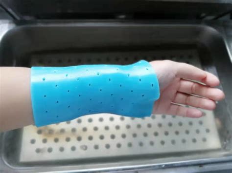 Image result for Splint Material