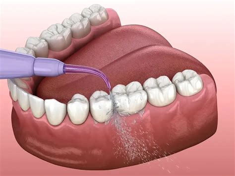 What are the Techniques of Dental Flossing