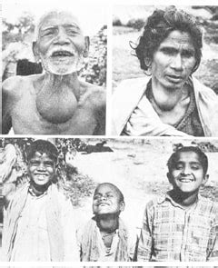 Goitre: A salty problem - India Today