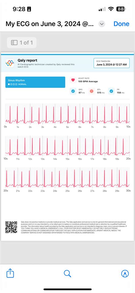 Prolonged QT Interval : r/askCardiology