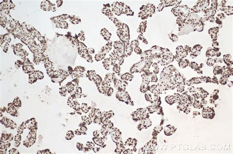 Mono/Di/Tri-Methyl-Histone H3 (Lys4) antibody (84908-1-PBS) | Proteintech