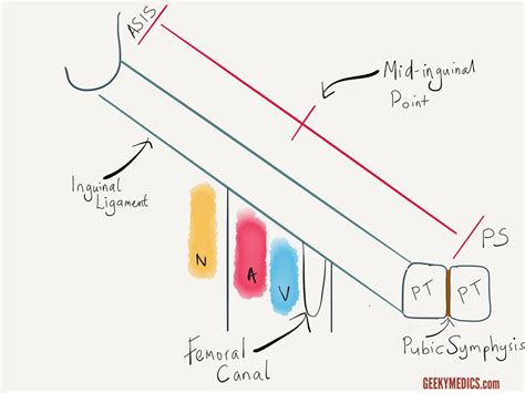 Hernias | Inguinal, Femoral, Umbilical | Geeky Medics
