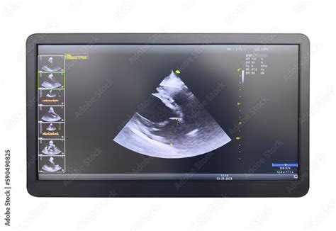 Image result for Ultrasound Scanner Depth Control