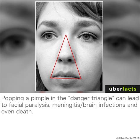 Danger triangle of the face | Cose interessanti, Salute e benessere, Trivia
