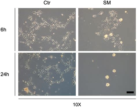 Simulated Microgravity Modulates Focal Adhesion Gene Expression in ...