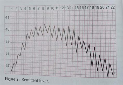 Fever Types 的图像结果