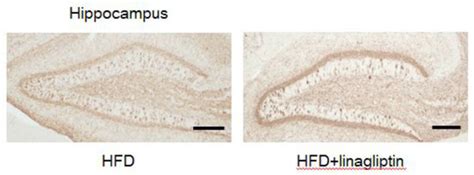 The Dipeptidyl Peptidase-4 Inhibitor Linagliptin Ameliorates High-fat ...