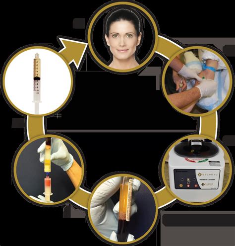 Injectable PRF 的图像结果