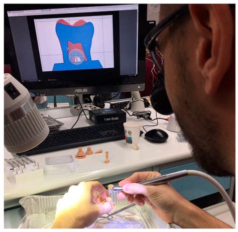 A Novel Self-Assessment Method for Training Access Cavity on 3D Printed ...