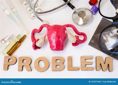 Different Types Of Uterus Problems at Shaun Schroeder blog