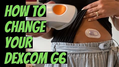 Image result for Dexcom G6 Tutorial YouTube