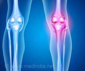Oyster-Inspired Bone Glue Could Transform Fracture Treatment
