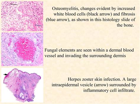 Tissue Processing in Histopathology 的图像结果