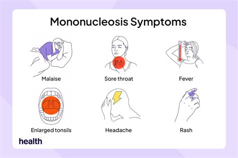 Signs and Symptoms of Mononucleosis (Mono) Explained