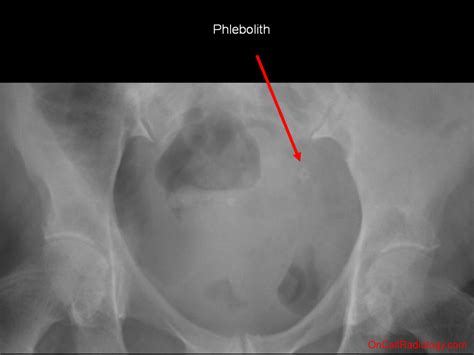 On Call Radiology - common radiology findings on call and in the ...