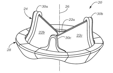 Anatomically Approximate Prosthetic Mitral Valve - Eureka | Patsnap