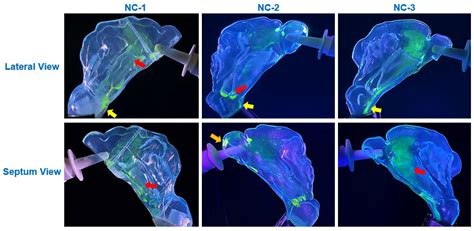 Enhancing Physiological Realism in Nasal Spray Deposition Studies ...
