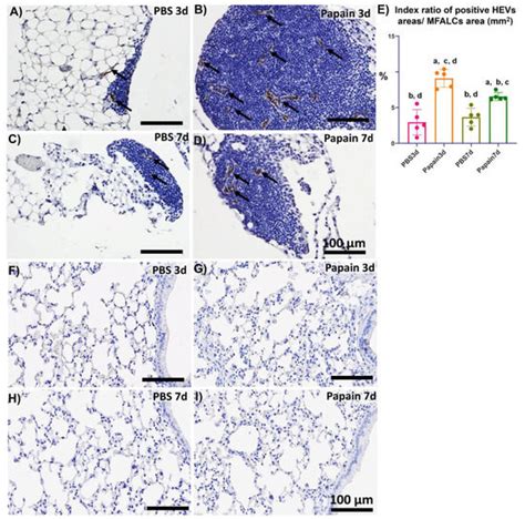 Possible Crosstalk of the Immune Cells within the Lung and Mediastinal ...