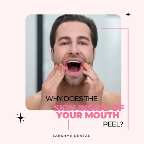 Why does the skin inside of your mouth peel? | We usually ne… | Flickr