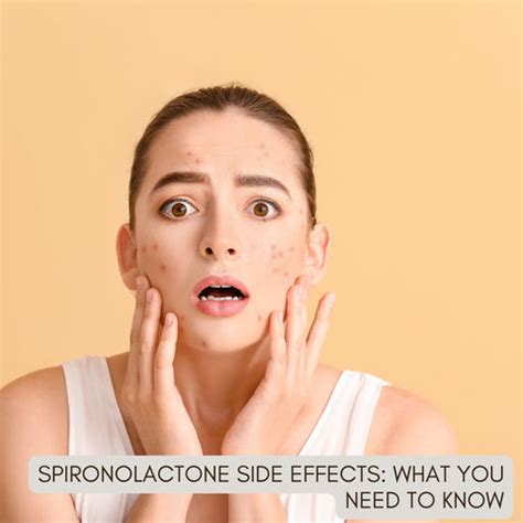 How Spironolactone Treats Acne: Benefits and Dosage | Clinikally