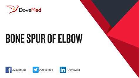 Bone Spur of Elbow