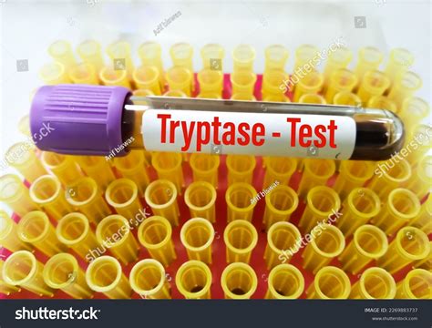 Tryptase Blood Test
