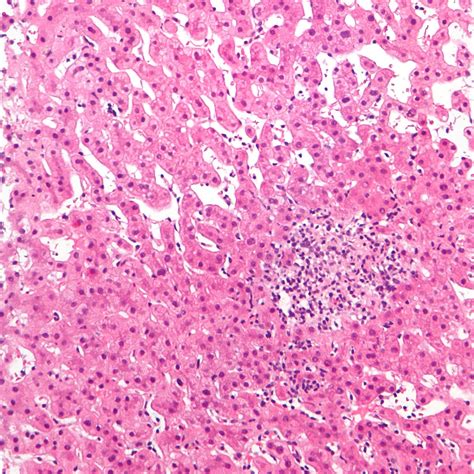 5 STDs That Require Yearly Testing and their Symptoms