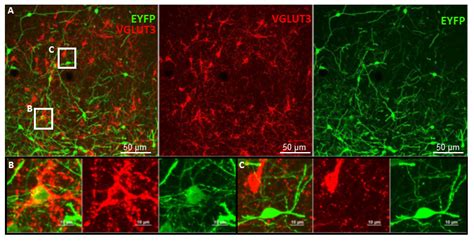 A New Player in the Hippocampus: A Review on VGLUT3+ Neurons and Their ...