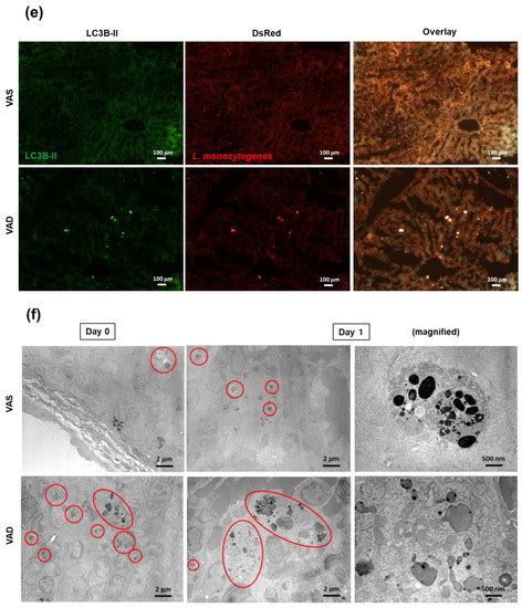 Vitamin A Promotes the Fusion of Autophagolysosomes and Prevents ...
