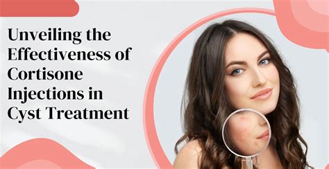 The Effectiveness of Cortisone Injections in Cyst Treatment | Clinikally