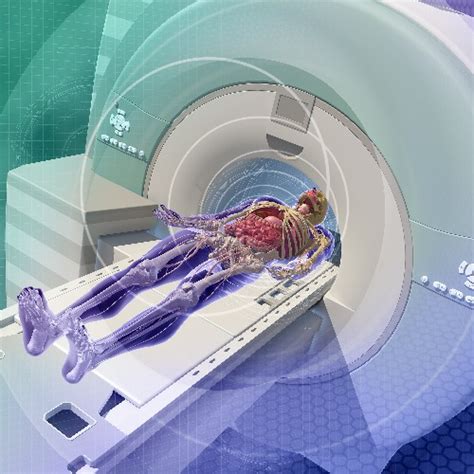 Image result for Radionuclide Scan