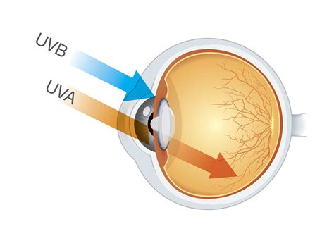 Can Your Eyes Get Sunburned