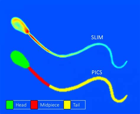 New imaging technique may help predict fertility of sperm in IVF