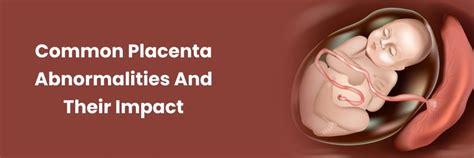 Understanding Placenta Abnormalities: Impact & Types